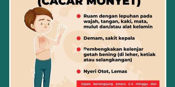 Cacar monyet