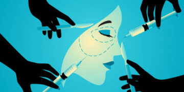 Ilustrasi operasi plastik. (foto: istimewa)