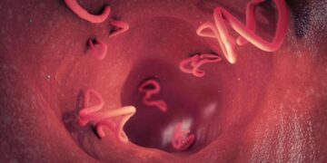 Ilustrasi tubuh mengalami 'cacingan'.(Foto:Istimewa).