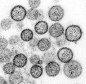 Hantavirus.(Image: wikipedia)